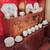 Mint China Dishes set for 12 " 96 pcs" ROSENTHAUL " Germany 1968 2 thumbnail