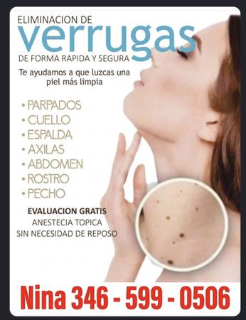 Verrugas 1