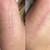 ProCell Microchanneling-Real Skin Rejuvenation 4 thumbnail