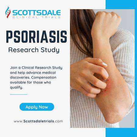 Earn for Paid Participation – Psoriasis – Clinical Study 1