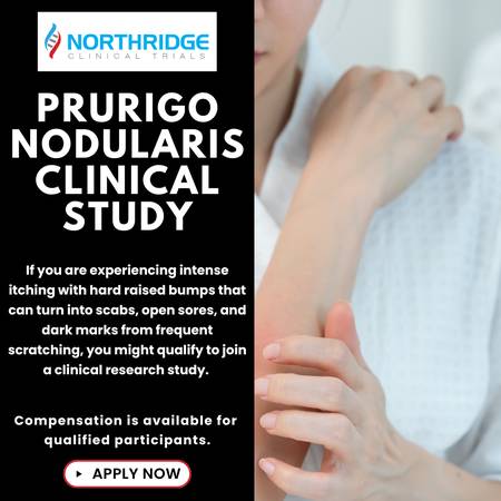 Join a Clinical Study for Prurigo Nodularis 1