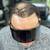 Male Pattern Baldness - Book Now 17 thumbnail