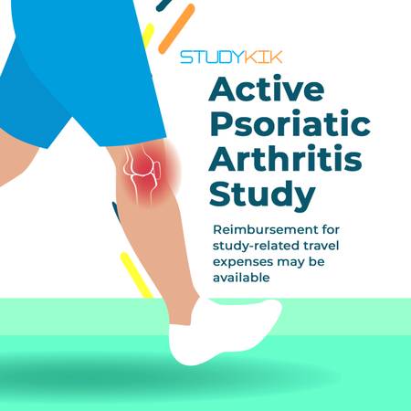 Psoriatic Arthritis with Flare Ups Study ✅ Compensation for study part 1