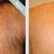 Brazilian/Manscaping - Full Body Trimmer Special (305)847- 1972 12 thumbnail