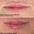 2-DAY BOTOX CERTIFICATION COURSE: BASIC & ADVANCED 7 thumbnail