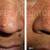 BRAZILIAN WAXING, SHAVING $50 for WOMEN & MEN $65 ( CRACK & FRONT 👍❤ 14 thumbnail