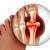 Join a Paid Gout Research Study 2 thumbnail