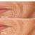 NEW BEAUTYBIO GloPro At-Home Microneedling Pen Tool 6 thumbnail