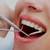 Free Dental Cleaning, X-Rays and Complete Comprehensive Exam 2 thumbnail