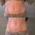 Colonics Detox  Sauna therapy Gut Health 15 thumbnail