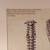 12×16 Print Of Spinal Column In 16x20 Frame 4 thumbnail