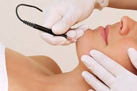 FREE electrolysis- (hair removal) 1