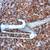 13-foot Flexrake Compound "Passthru" Tree Pruner & Saw Blade (Used) 4 thumbnail