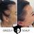 Scalp Micropigmentation for Women - Grizzly Scalp (619)606-0102 2 thumbnail