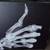 X-RAYS ON CANVAS 2 thumbnail
