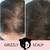 Scalp Micropigmentation for Women - Grizzly Scalp (619)606-0102 10 thumbnail