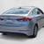 2017 Hyundai Elantra  SE Sedan 5 thumbnail
