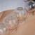 $59/60 mins massage/acupuncture+30 mins cupping 1 thumbnail