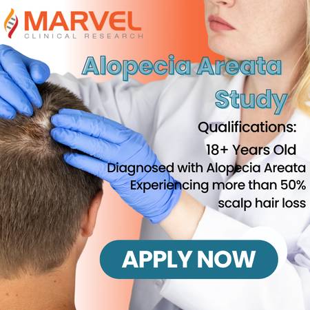 Earn up to $3,000 - Join a Study for Alopecia Areata 1
