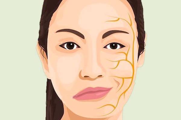 Need help shooting a short video about facial paralysis ($100/hr) 1