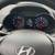 2017 Hyundai Veloster type R Spec 25,000 Mls 4 thumbnail