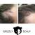 Scalp Micropigmentation for Women - Grizzly Scalp (619)606-0102 8 thumbnail