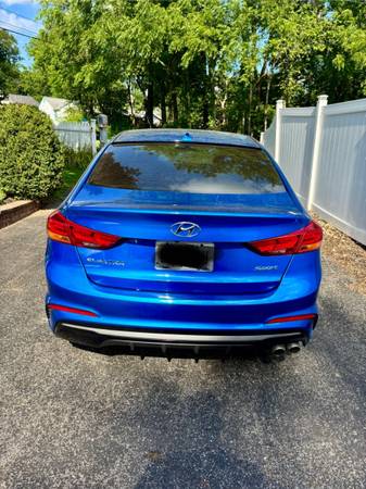 2017 Hyundai Elantra Sport - $9,500 (Patterson)63436936854017123