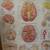 MEDICAL ANATOMY WALL CHARTS 9 thumbnail