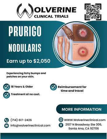 Purigo Nodularis Clinical Study 1
