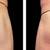 💸  EMSculpt You Can Actually Afford 9 thumbnail