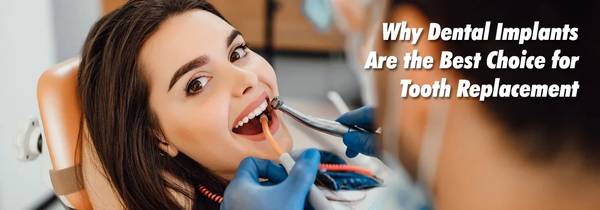 Best Implant dentist in Ahmedabad 1