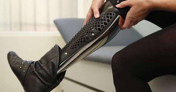 WE HELP AMPUTEES WITH QUALITY PROSTHETIC LEGS. WE ACCEPT MEDICARE! 1
