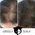 Scalp Micropigmentation for Women - Grizzly Scalp (619)606-0102 4 thumbnail
