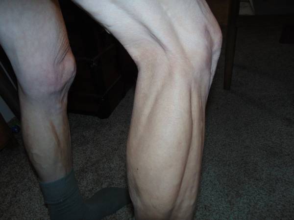 At age 63 is it normal to still have nice calves 1