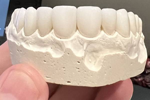 Dental Work for Trade 1