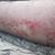 FUEL OIL TANK 5 thumbnail