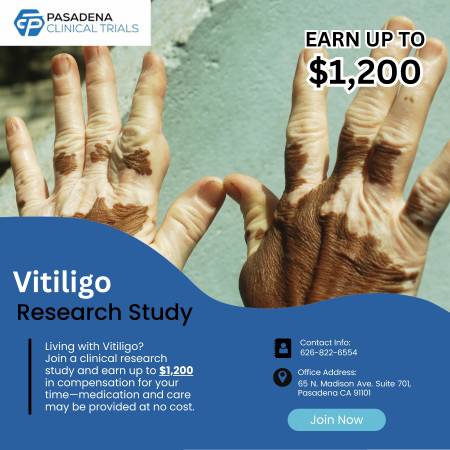 Earn for Participation - Vitiligo Study 1