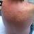🐞THE #1 BED BUG REMOVAL HEAT TREATMENT-50% OFF-#1  🔥833-6-BED-BUG< 15 thumbnail