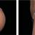 💸  EMSculpt You Can Actually Afford 6 thumbnail
