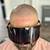 Male Pattern Baldness - Book Now 14 thumbnail
