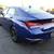 2021 Hyundai Elantra  SEL Sedan 5 thumbnail