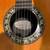 Guitar Ovation 5 thumbnail