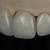 Dental Lab Technician 1 thumbnail
