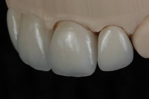 Dental Lab Technician 1
