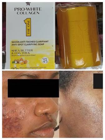 Pro-White Collagen Anti-Spot Clarifying Soap With Egg Yolk & Shea Butt 1
