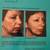 Beauty Treatments in Aurora (Aurora) 5 thumbnail