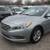 2015 Hyundai Sonata SE SE 4dr Sedan 1 thumbnail