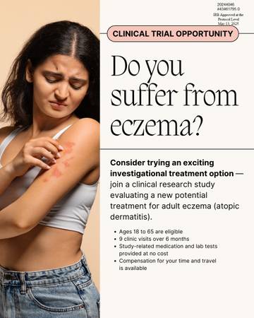 ✅ Paid Eczema Study 1